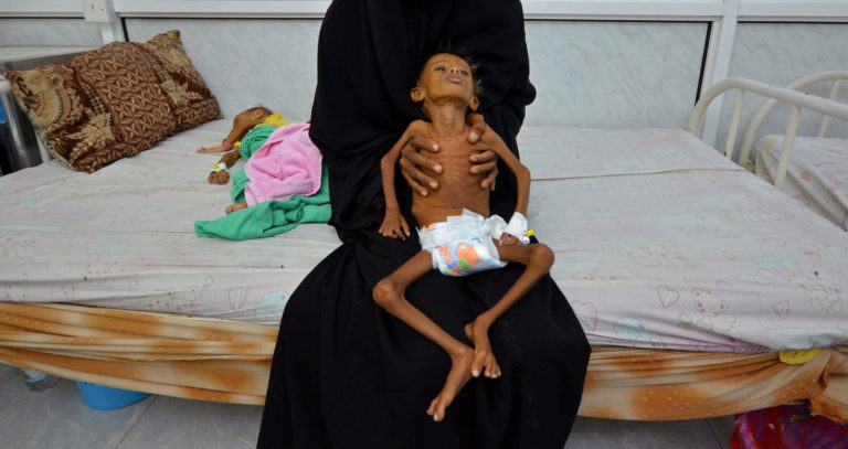 TRANSCEND MEDIA SERVICE » Starving and Bombed Children of Yemen Seek ...